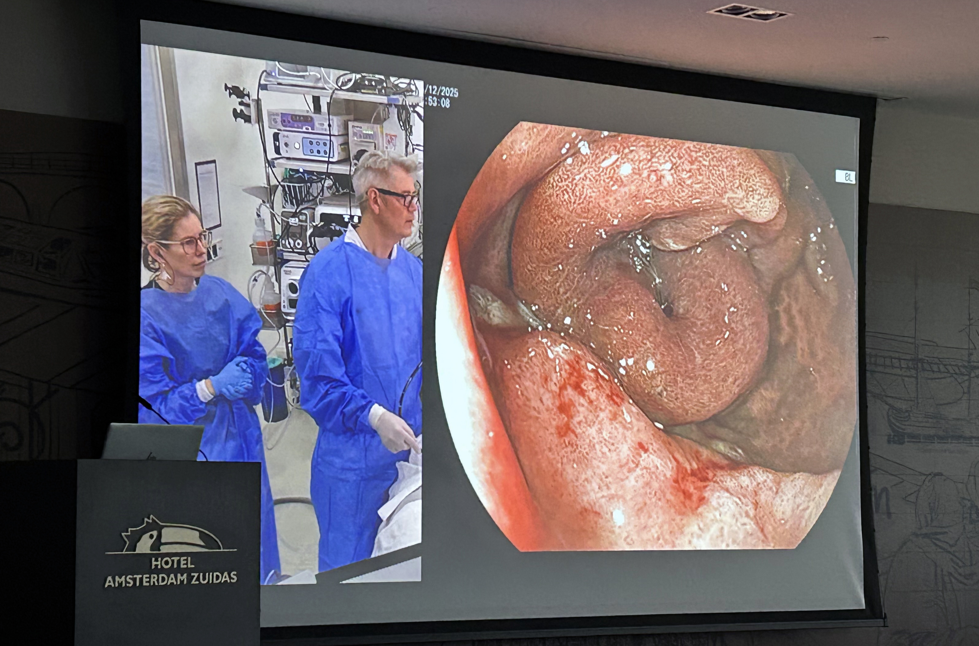 Live procedure broadcast to the auditorium